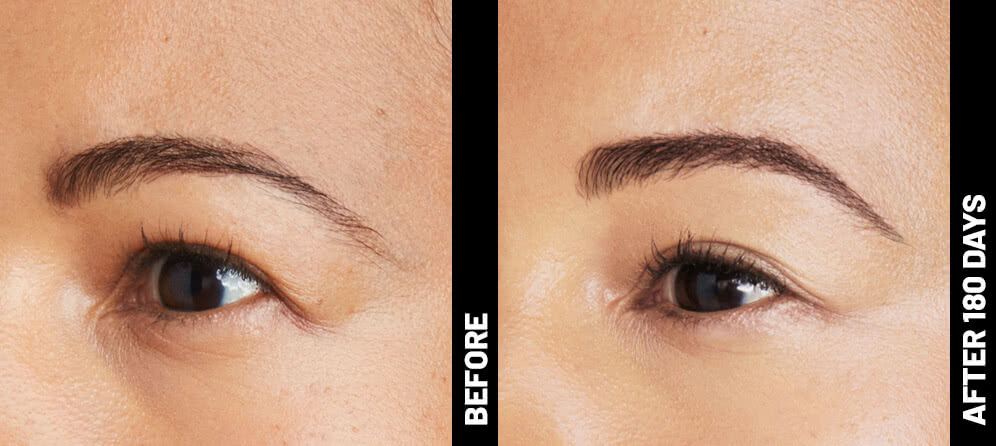 blinder-erin-brow-after-180