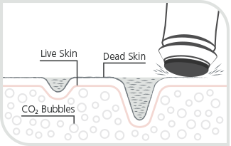 exfoliate Oxygeneo Facials