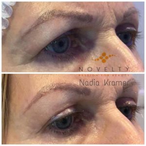 Eye-Treatment-300×300