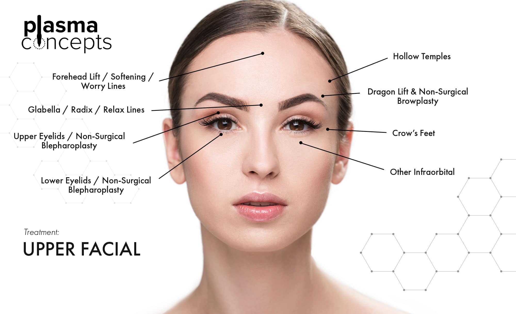 Treatment-Guide-Advanced-Upper-plasma concepts The gold standard for nonsurgical lifting and skin tightening at a glance.